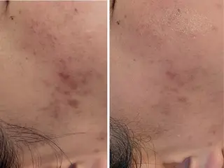 シミケア専門サロンLICCO’S所属・シミケア専門サロン LICCO’S岡崎のエステ・リラクイメージ