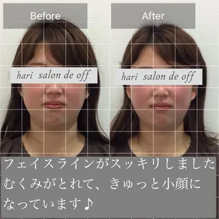 整体×美容鍼灸 鍼灸師Miyanoのエステ・リラクイメージ