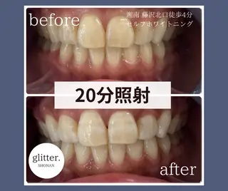 マツエク・マツパ glitter.SHONAN所属・ホワイトニング専門店 glitterのその他イメージ