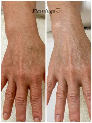 40代からの爪を守る ×ケア重視サロン♡のネイルデザイン