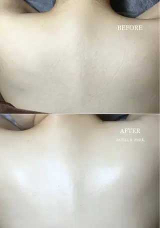 HOTEL&PARK . ワックス脱毛のエステ・リラクイメージ