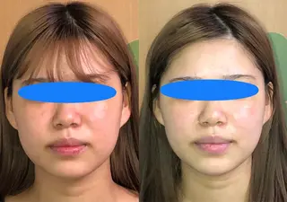 春日井トータルからだ サロンふくふくのエステ・リラクイメージ