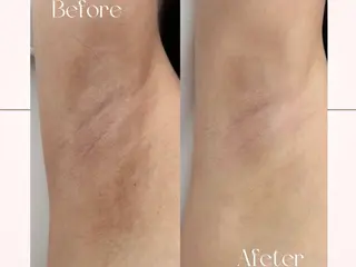 小顔専門看護師クリニカルサロンCOCO所属・小顔と美肌サロン クリニカルサロンココのエステ・リラクイメージ