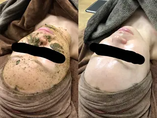 Rerire by electroのエステ・リラクイメージ