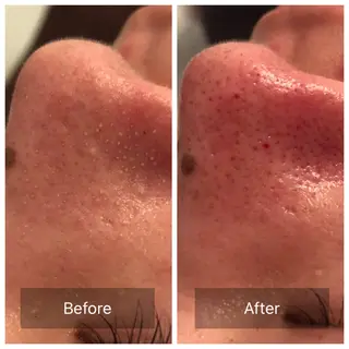 Lumiere despoir所属・Lumiere despoirのエステ・リラクイメージ