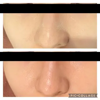 ミディアム カラー パーマ ヘアアレンジ メンズ キッズ ネイル マツエク・マツパ アイブロウ ニキビ特化型エステ 🍓最短で肌質改善のエステ・リラクイメージ