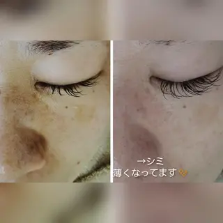 パーソナルカラー・骨格/顔診断【eternity】所属・【トータル美容】 Eternityのその他イメージ