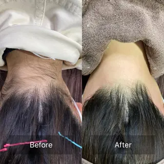 産毛専門店 Bittoのエステ・リラクイメージ