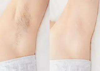 Roots所属・黄土よもぎ蒸し &リラクのエステ・リラクイメージ