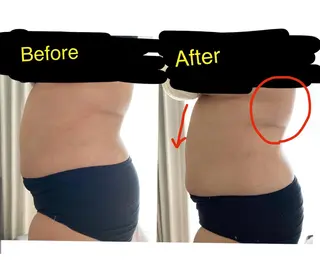 子宮矯正/腸揉み/ シュガーリング脱毛のエステ・リラクイメージ