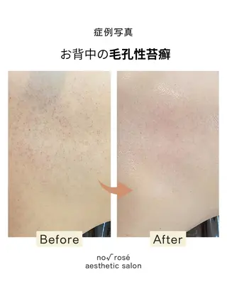 ノールート ロゼのエステ・リラクイメージ