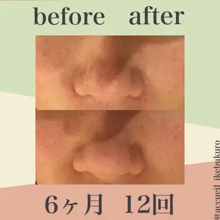 ミディアム カラー パーマ ヘアアレンジ メンズ キッズ ネイル マツエク・マツパ ニキビ・肌質改善専門 ♡人生が変わるサロンのエステ・リラクイメージ