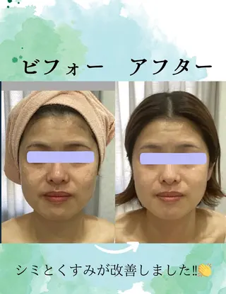 エステ♡Eden Asamiのエステ・リラクイメージ