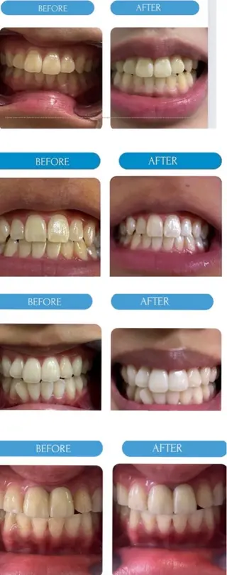 韓国式ホワイトニング 大阪梅田1480円のエステ・リラクイメージ