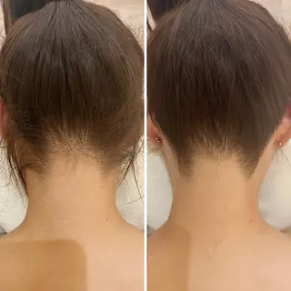 うなじ脱毛/美肌脱毛 LABELのエステ・リラクイメージ