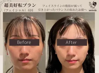 総合美容サロン LOVEME渋谷本店のエステ・リラクイメージ