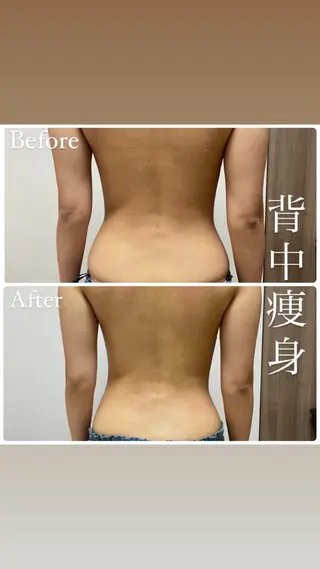 beautysalon RAVIS所属・東大阪/韓国肌管理/ 痩身バスト専門店のエステ・リラクイメージ