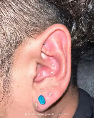Jewelit所属・耳つぼジュエリー Jewelitのその他イメージ