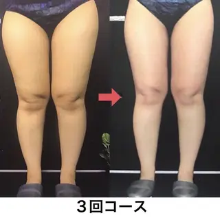 横浜エステサロン R-ing　リングのエステ・リラクイメージ