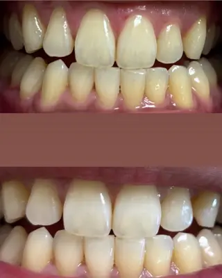 韓国式ホワイトニング 大阪梅田1480円のエステ・リラクイメージ