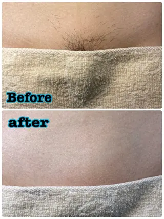 sugaring salon Malo所属・シュガーリングサロン Maloのエステ・リラクイメージ