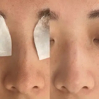 Lien ~beauty salon~所属・福島⌇毛穴専門サロン ⌇﻿モニター募集のエステ・リラクイメージ