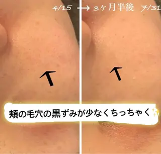 luana beauty所属・kana ハーブピーリング🌿のエステ・リラクイメージ