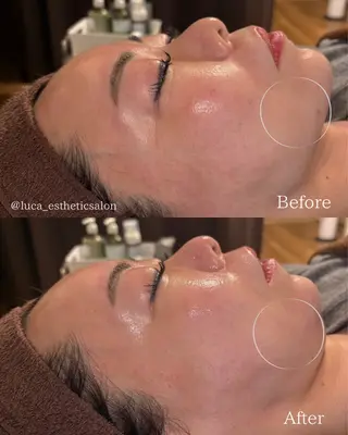 Luca所属・Luca ﾙｶのエステ・リラクイメージ