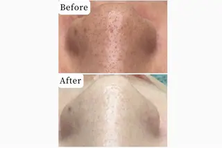 ハーブピーリング専門 muro.のエステ・リラクイメージ