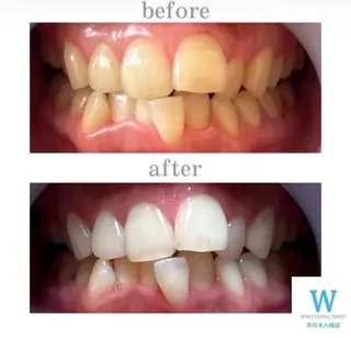 ホワイトニング ショップ本八幡店のエステ・リラクイメージ