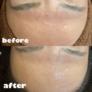 鈴木 杏奈のエステ・リラクイメージ