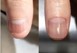 ネイル 北浦和 自爪育成ケアのネイルデザイン