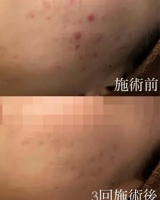 エミルカ　自由が丘店所属・花島 悠のエステ・リラクイメージ