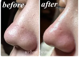 結果重視｜毛穴エステ ｜友綱理恵のエステ・リラクイメージ