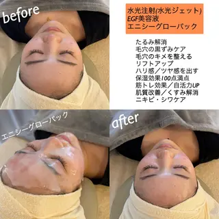 うなじ脱毛/美肌脱毛 LABELのエステ・リラクイメージ