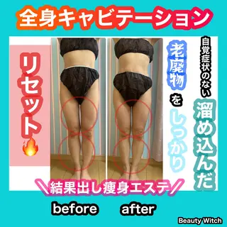 痩身/脱毛/ネイル HARUKAのエステ・リラクイメージ