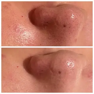 for woman所属・森 美優のエステ・リラクイメージ