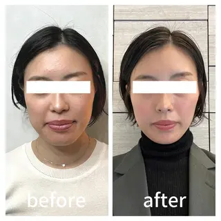 小顔サロン AMYONのエステ・リラクイメージ