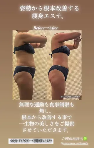 Bodyリカバリー栗山整骨院所属・Arisa✨老廃物や 脂肪をお掃除💪のエステ・リラクイメージ