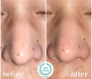 Beauty salon ichi所属・ビューティーサロン イチasukaの眉毛・アイブロウイメージ