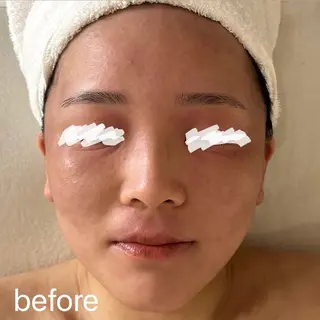 肌質改善|天王寺 For...はるかのエステ・リラクイメージ