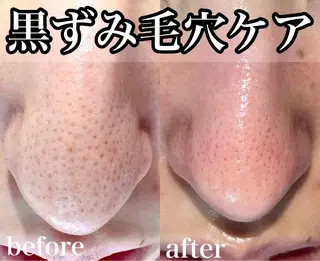 アイラッシュ＆フェイシャルサロン　ベアトリーチェ所属・医療提携美容サロン Beatriceのエステ・リラクイメージ