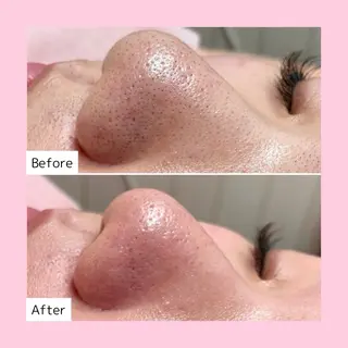 韓国肌管理専門店　White labo 新潟店所属・韓国肌管理専門店 Rihoのエステ・リラクイメージ