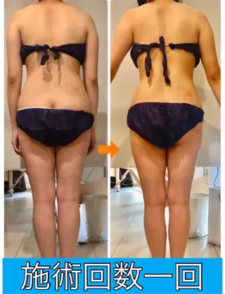 ロング カラー パーマ ヘアアレンジ メンズ キッズ ネイル マツエク・マツパ ‍痩身＆ボディ 結果出し🌟丹野のエステ・リラクイメージ