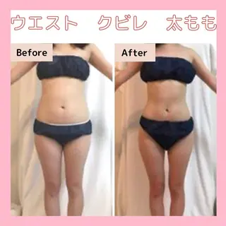 エステサロン　Sブランペタル所属・三沢市エステサロン Sブランペタルのエステ・リラクイメージ