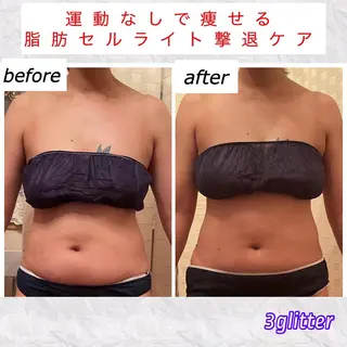 3glitter 肌質改善＆痩身のエステ・リラクイメージ