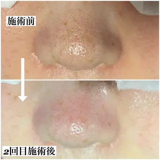 MUKU所属・毛穴専門サロン MUKUムクのエステ・リラクイメージ