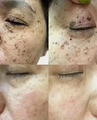 ビューティーリゾート麗所属・于 麗影のエステ・リラクイメージ