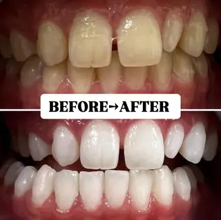 メンズ キッズ 歯科提携サロン ホワイトニング豊中のその他イメージ