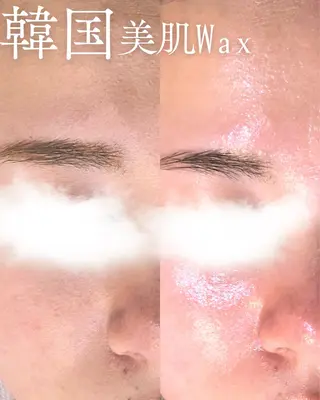 abbellina×UNO出雲塩冶店《ウノ》所属・フェイシャルエステ 🫧琉衣のエステ・リラクイメージ